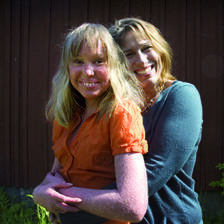 Iktyossjuka Nathalie gillar när folk frågar om hennes ovanliga sjukdom