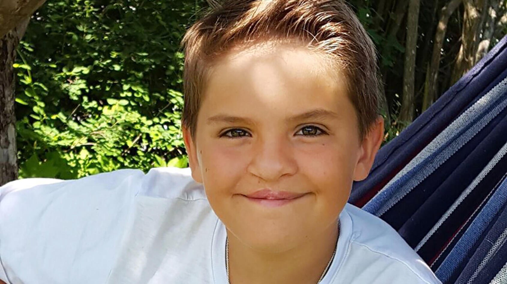 12-årige Albert hjälper barn med gomspalt!