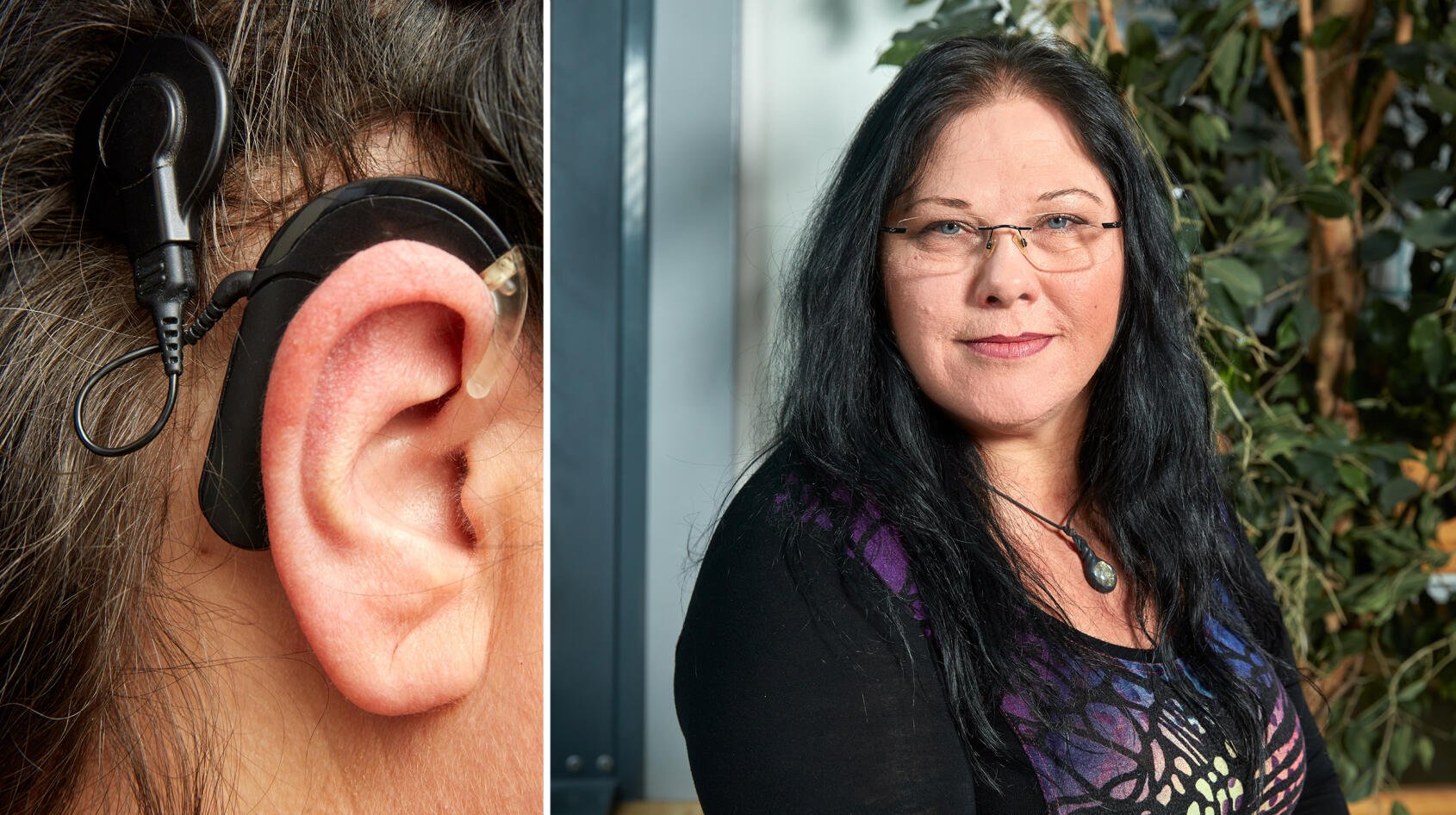 Cathrines tinnitus försvann: ”Implantatet blev min räddning”