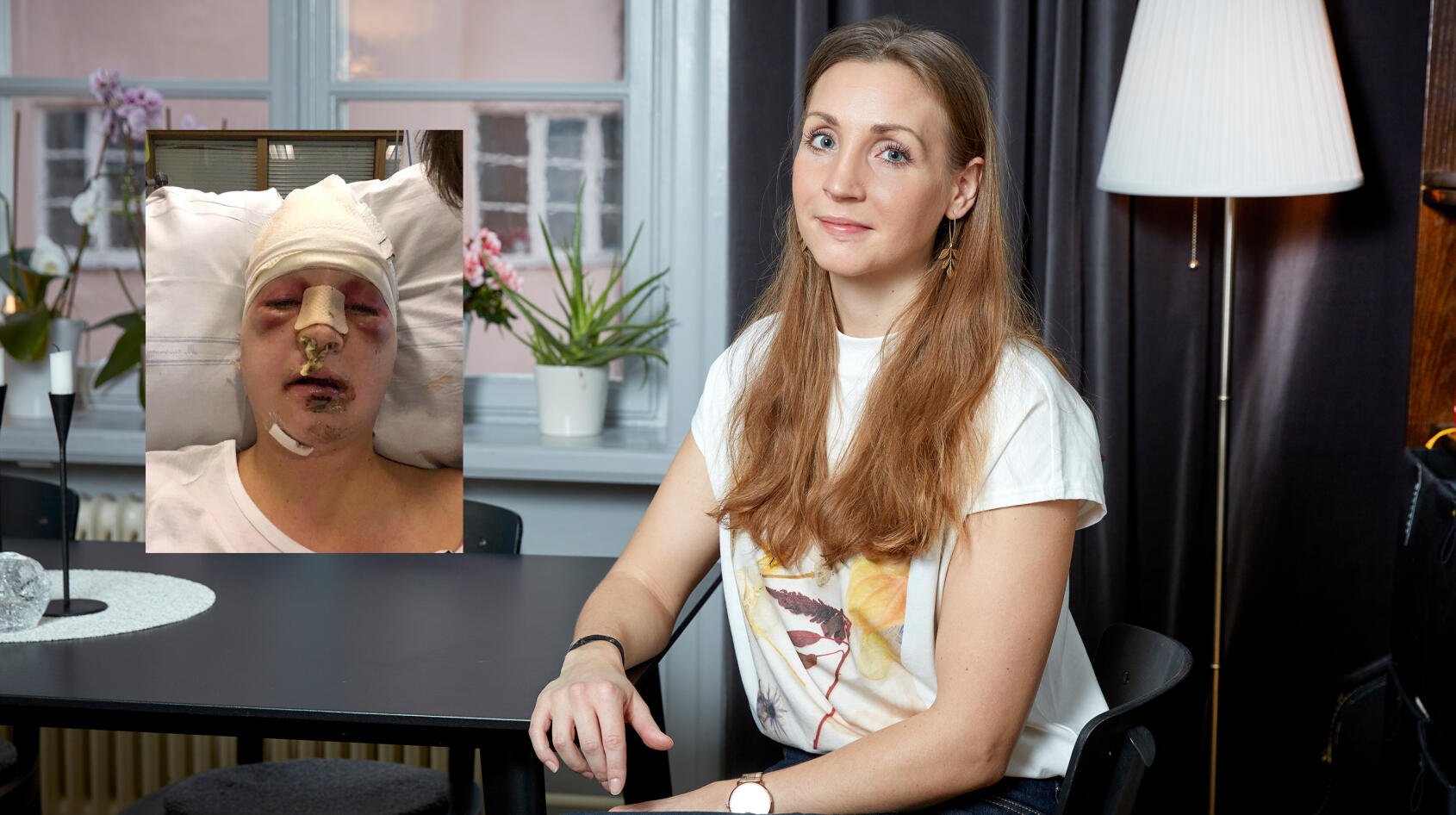 Martina fick ansiktet krossat av nedrasande järnbalk