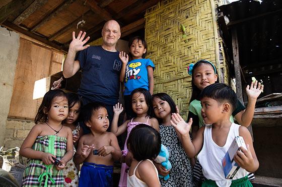 Operation Smile: Efter operationen kastar ingen längre sten