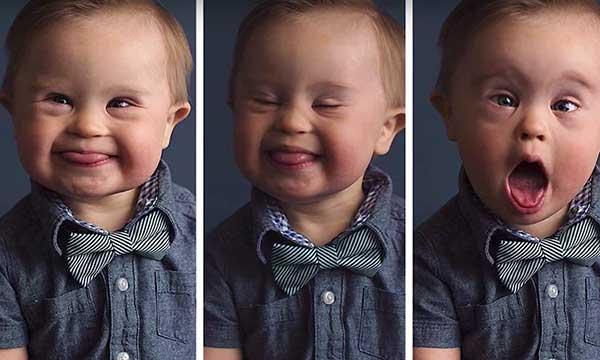 TV: Agenturen ville inte ha bilder på pojke med Downs syndrom