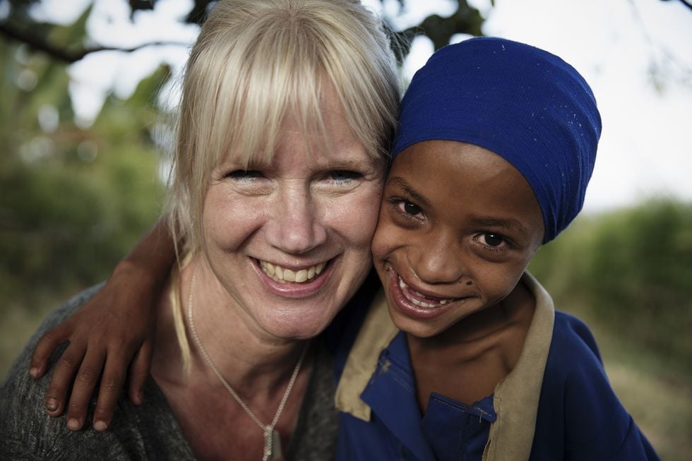 Malin är kirurg och volontär för Operation Smile: 