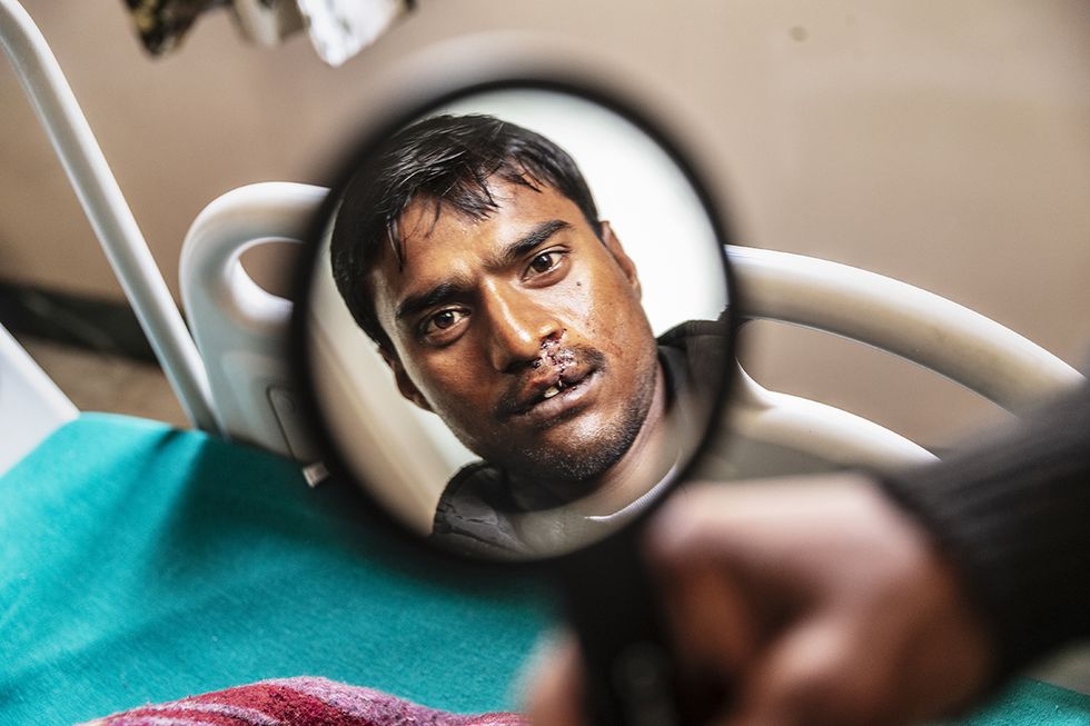 Operation Smile: 
